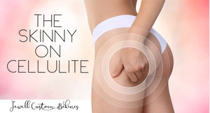 The Skinny on Cellulite